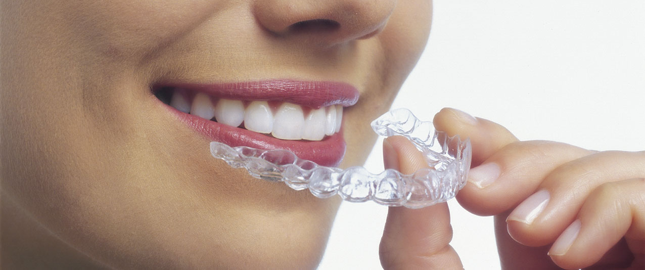 Healthy Benefits Of Invisalign